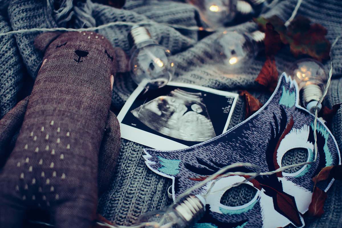 pregnancy ultrasound photo surrounded by string lights ultrasound