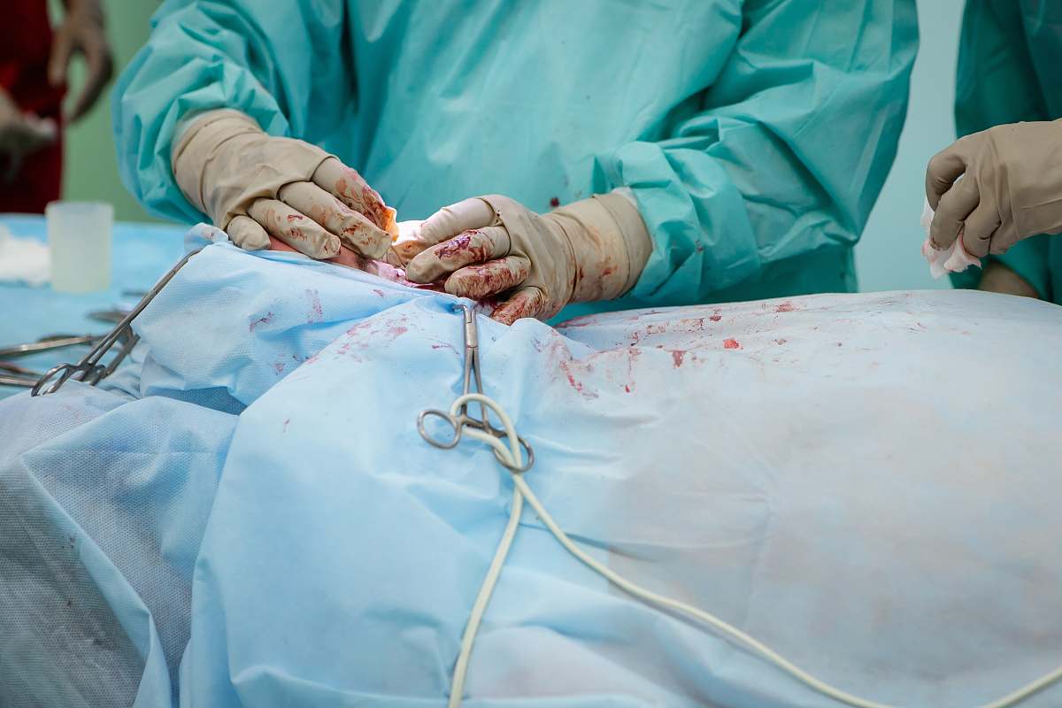 surgery person in operation gown holding scissors hospital