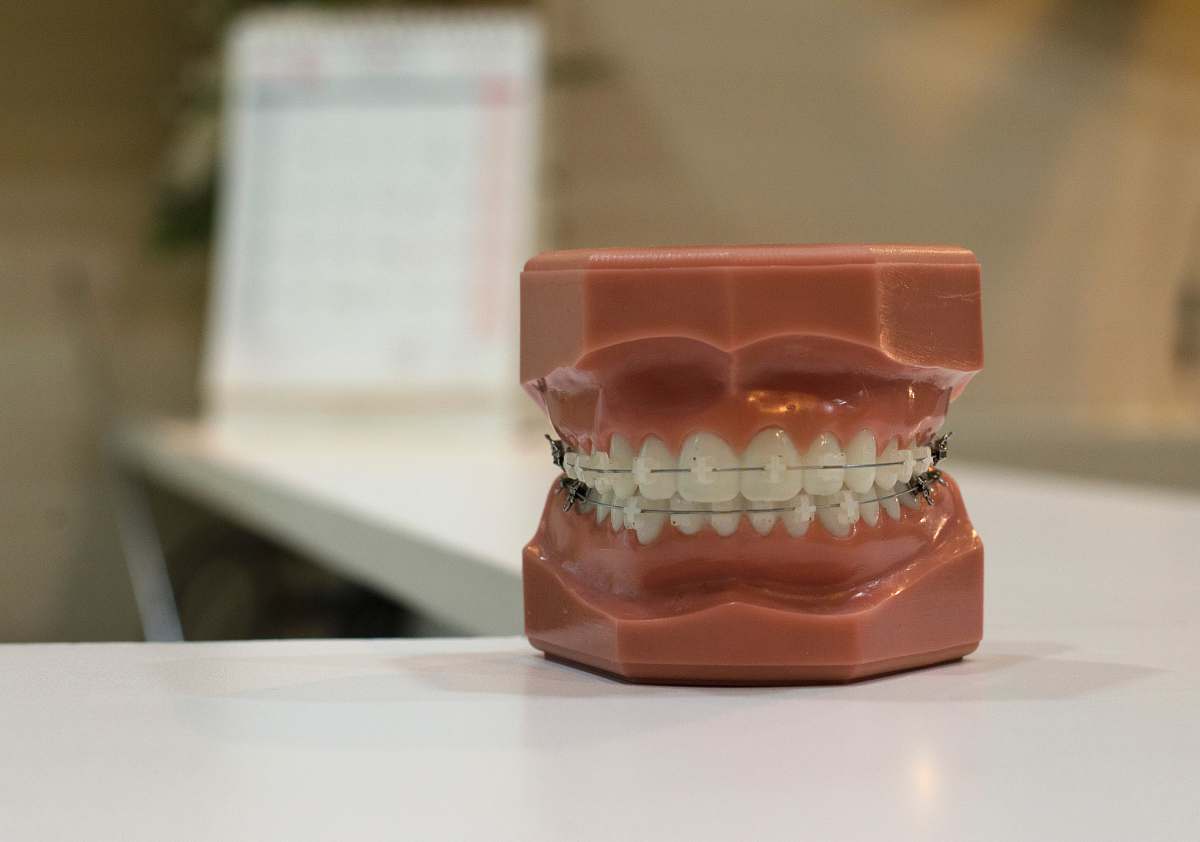 braces denture on white board dental