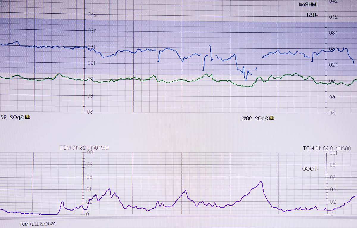 blue lifeline on white paper pregnancy