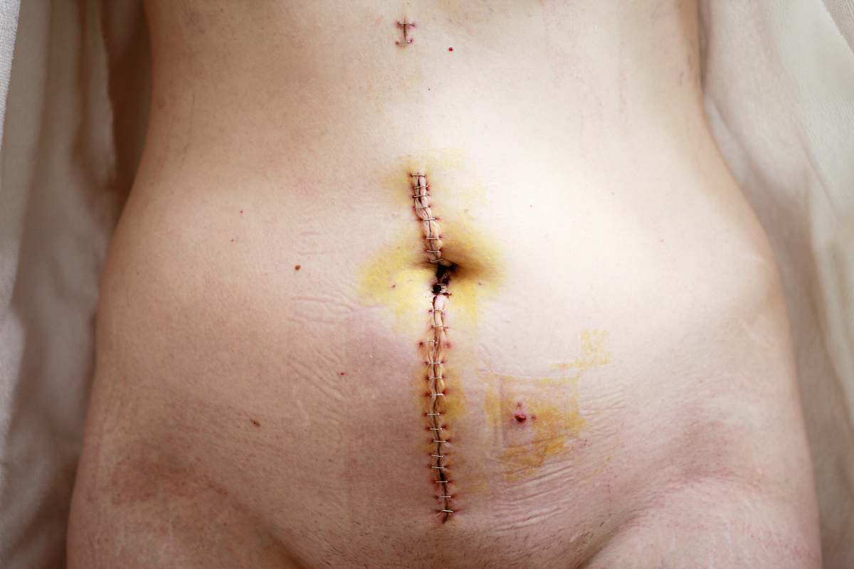 human skin condition 