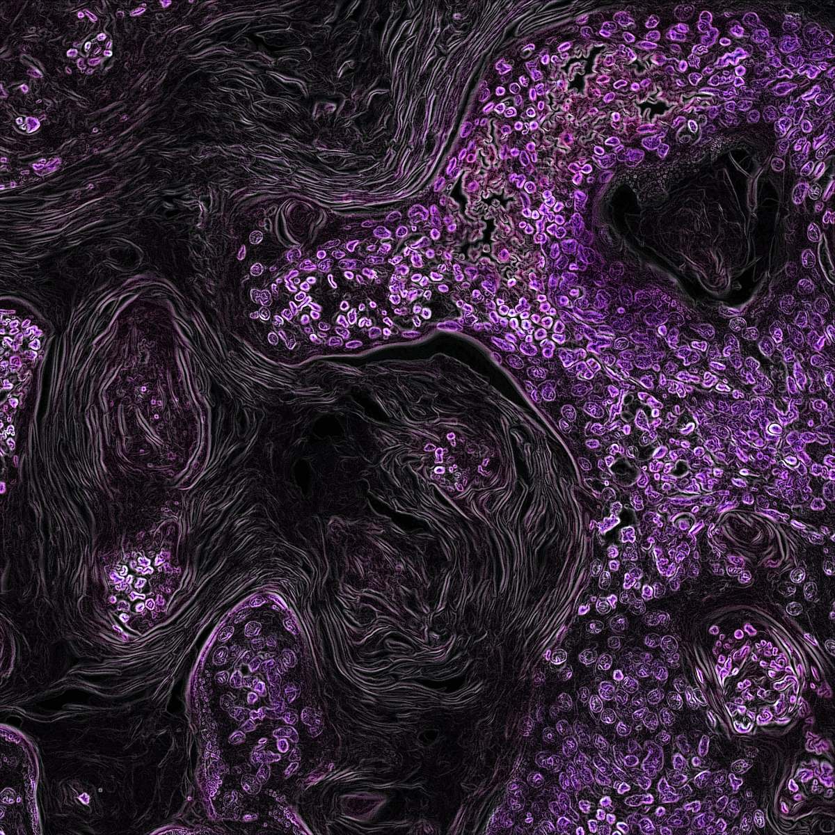 ornament  purple