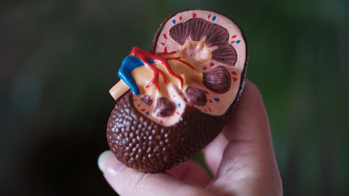 human brown kidney decor plant