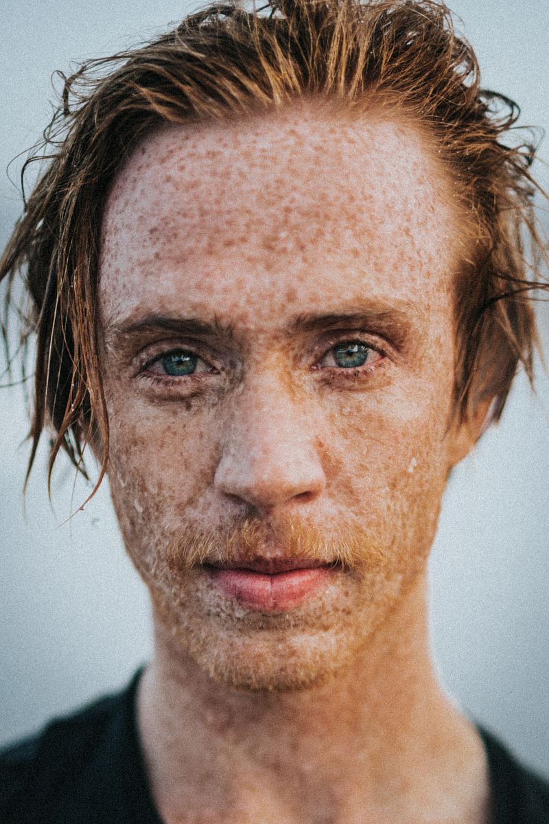 closeup photo of man's face with marks