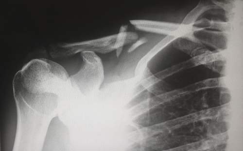 x-ray human X-ray result chart ct scan