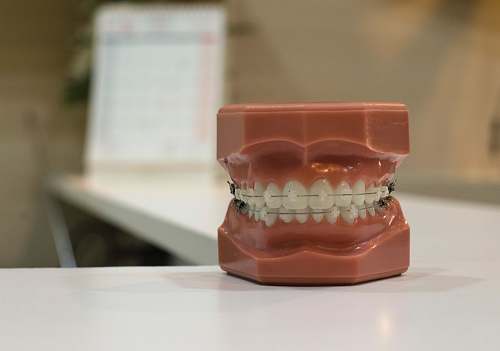 braces denture on white board dental