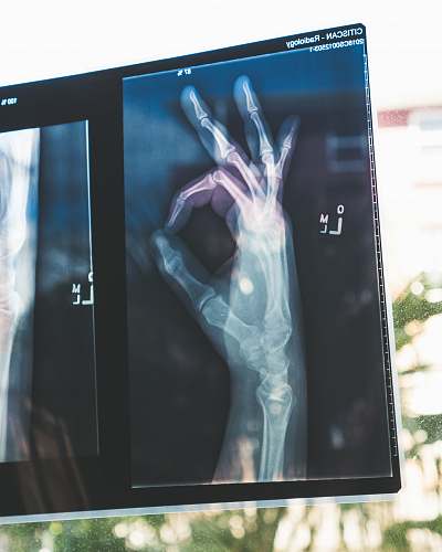 health citiscan result hand ok brisbane city