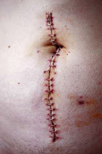 skin stitched stomach piercing