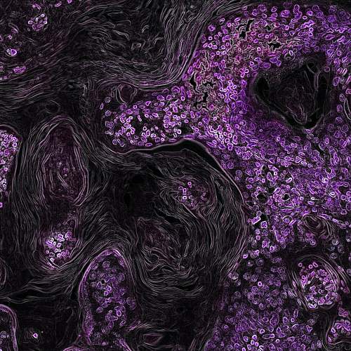 ornament  purple