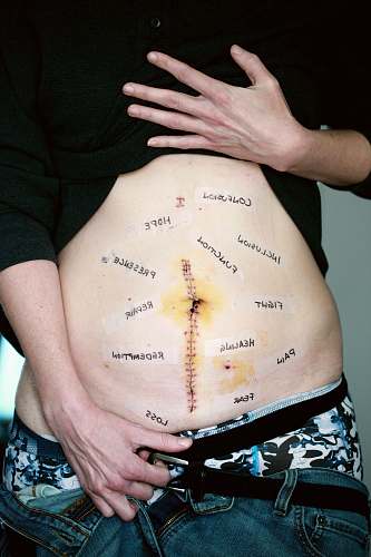skin person wearing black shirt showing tummy with text healthcare