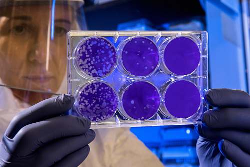 medical woman holding laboratory appratus public health