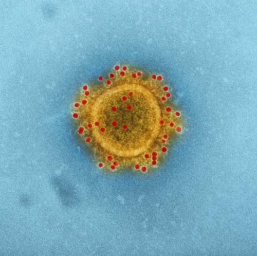 bacteria  stain